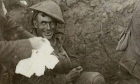 La guerra come una malattia